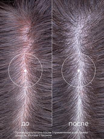 Фото Klorane Пион, шампунь для волос успокаивающий 400 мл