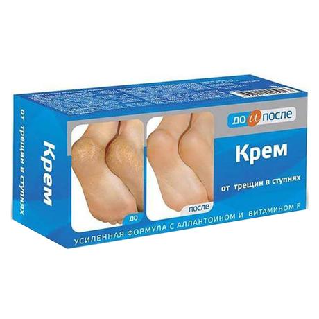 Фото До и После, крем для ног от трещин в ступнях, 150 мл