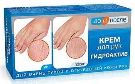Фото До и После Гидроактив, крем для сухой кожи рук, 100 мл