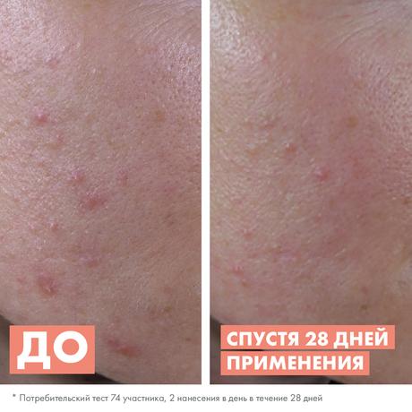 Фото Avene Клинанс Обновляющая сыворотка для жирной и комбинированной кожи 30 мл