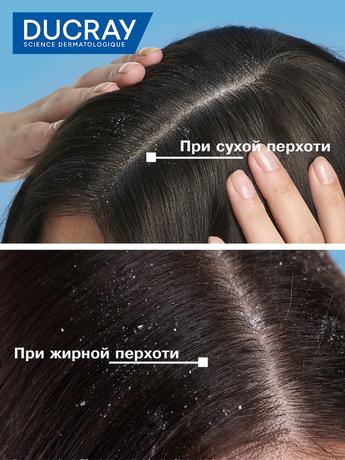 Фото Дюкрэ (Ducray) Kelual Squanorm, лосьон от перхоти, 200 мл