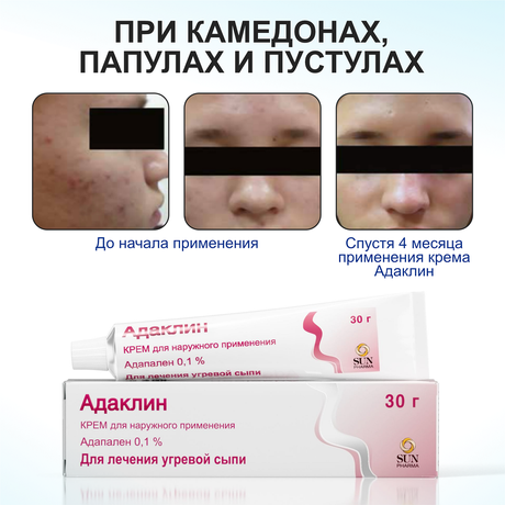 Фото Адаклин, крем 0.1%, 30 г