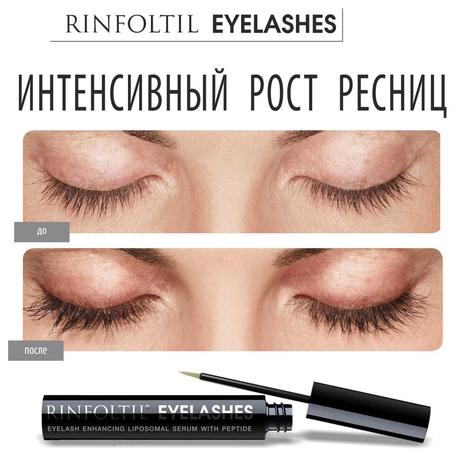 Фото Ринфолтил ресницы, сыворотка липосомальная для роста ресниц с пептидом 4 мл, 1 шт.