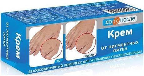Фото До и После, крем от пигментных пятен 50 мл, 1 шт.