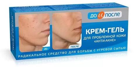 Фото ДО и ПОСЛЕ, крем-гель Анти-Акне для проблемной кожи, 50 мл