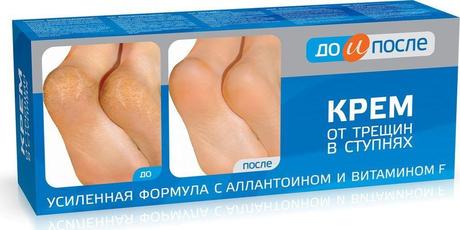 Фото До и После, крем от трещин в ступнях, 50 мл